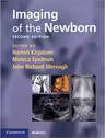 Imaging of the Newborn - Haresh Kirpalani, Monica Epelman, John Richard Mernagh