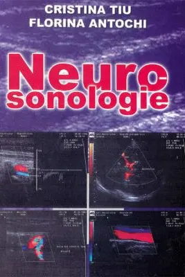 Neurosonologie - Cristina Tiu, Florina Antochi