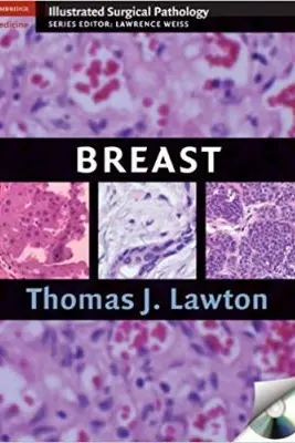 Breast