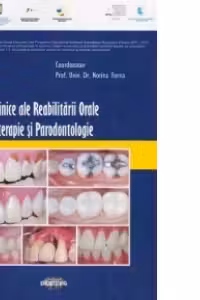 Aspecte clinice ale reabilitarii orale in odontoterapie si parodontologie