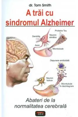 A trai cu sindromul Alzheimer