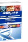Actualitati in tumorile intracraniene