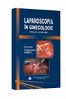 Laparoscopia in ginecologie. Manual universitar