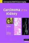 Carcinoma of the Kidney