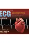 Ghid complet de interpretare ECG
