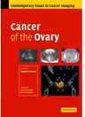 Cancer of the Ovary