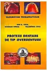 Proteze dentare de tip overdenture