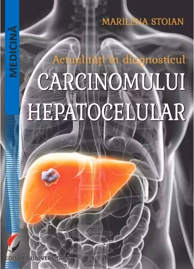 Actualitati in diagnosticul carcinomului hepatocelular