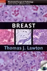 Breast