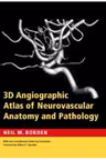 3D Angiographic Atlas of Neurovascular Anatomy and Pathology