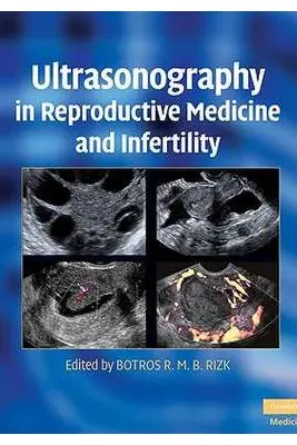 Ultrasonography in Reproductive Medicine and Infertility