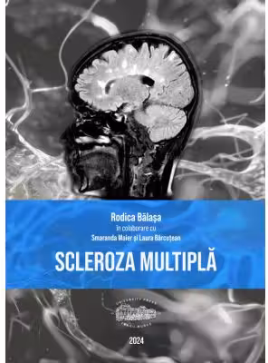 Scleroza multipla (print color)
