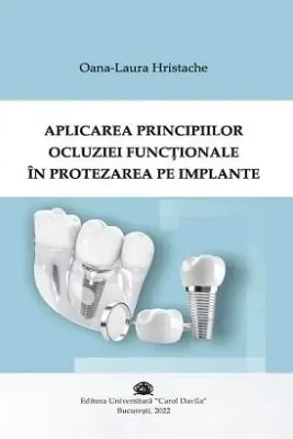 Aplicarea principiilor ocluziei functonale in protezarea pe implante