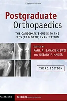 Postgraduate Orthopaedics: The Candidate's Guide to the FRCS (Tr & Orth) Examination - Paul A. Banaszkiewicz, Deiary F. Kader