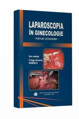 Laparoscopia in ginecologie. Manual universitar