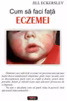Cum să faci față eczemei