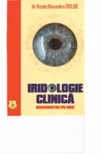IRIDOLOGIE CLINICA - DIAGNOSTIC PE IRIS