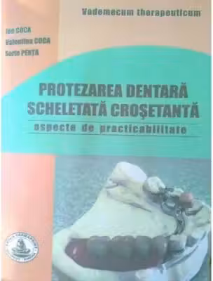 Protezarea dentara scheletata crosetanta. Practibilitate