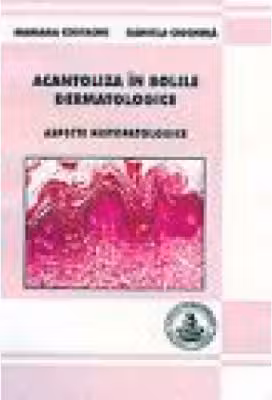 Acantoliza in bolile dermatologice - Mariana Costache, Daniela Ciochina