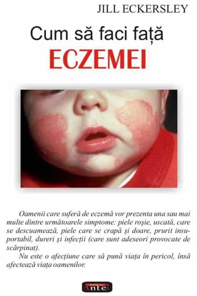 Cum să faci față eczemei