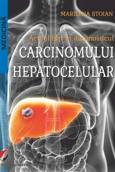 Actualitati in diagnosticul carcinomului hepatocelular
