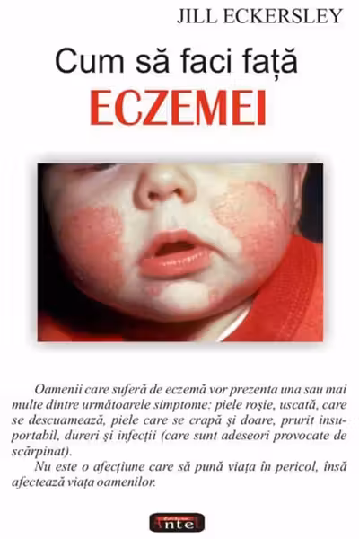 Cum să faci față eczemei
