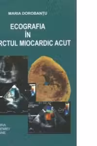 Ecografia in infarctul miocardic acut