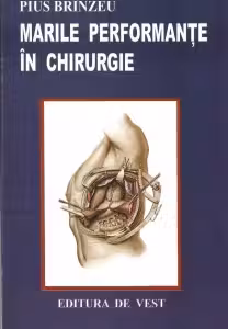 Marile performante in chirurgie