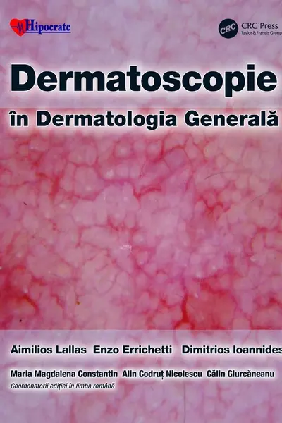 Dermatoscopie în Dermatologia Generală