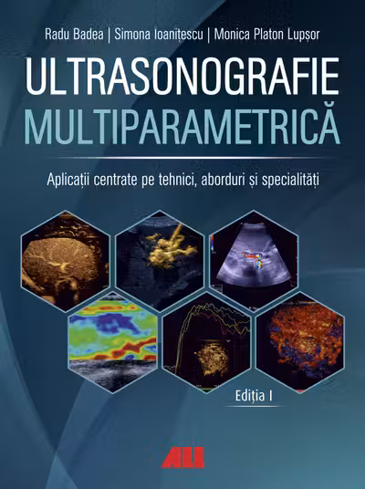 Ultrasonografie multiparametrica