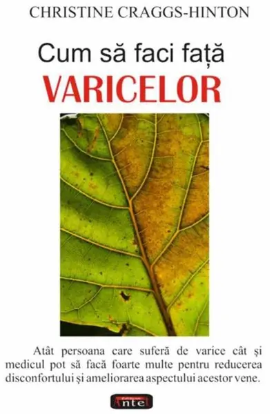 Cum să faci față varicelor