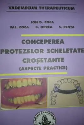Conceperea protezelor scheletate crosetante