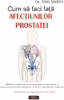 Cum sa faci fata afectiunilor prostatei