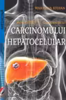 Actualitati in diagnosticul carcinomului hepatocelular