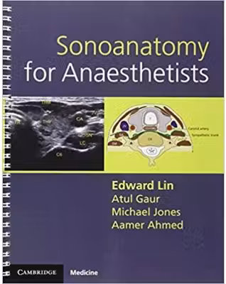 Sonoanatomy for Anaesthetists - Edward Lin, Atul Gaur, Michael Jones, Aamer Ahmed