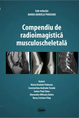 Compendiu de radioimagistica musculoscheletala