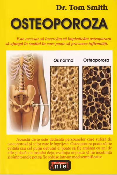 Osteoporoză
