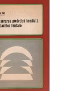 Restaurarea protetica imediata a arcadelor dentare