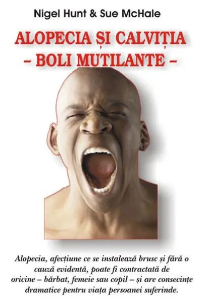 Alopecia și calviția