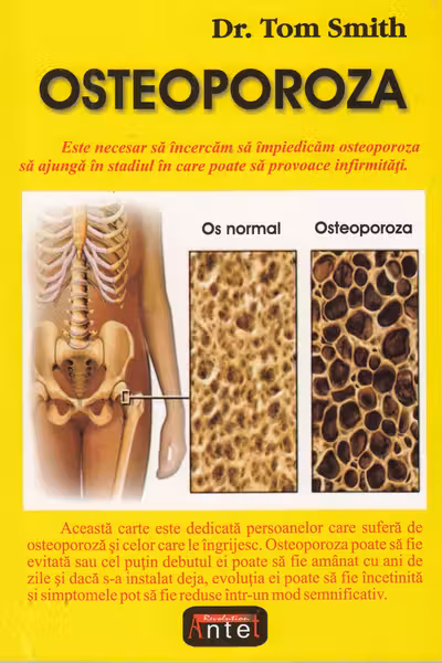 Osteoporoză