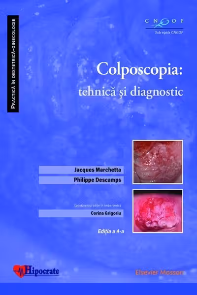Colposcopia: tehnica și diagnostic