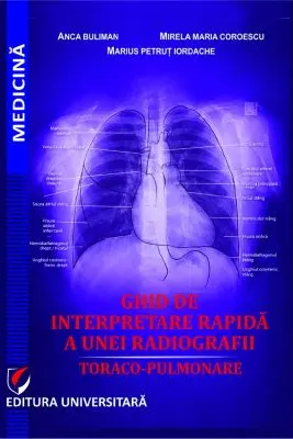 Ghid de interpretare rapida a unei radiografii toraco-pulmonare