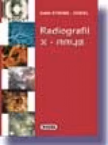 Radiografii / X-Rays. Editie Bilingva