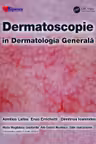 Dermatoscopie în Dermatologia Generală