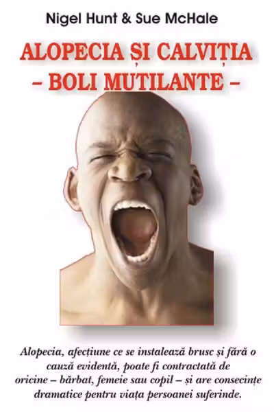 Alopecia și calviția