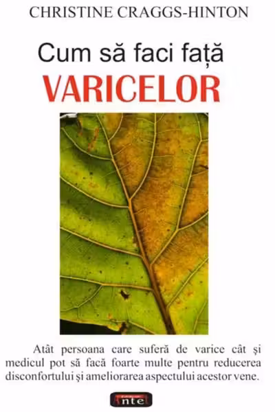 Cum să faci față varicelor