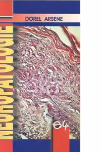 Neuropatologie (Lucrari de medicina)