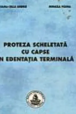 Proteza scheletata cu capse in edentatia terminala
