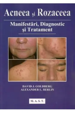Acneea si rozaceea Manifestari deagnostic