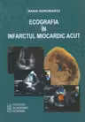 Ecografia in infarctul miocardic acut